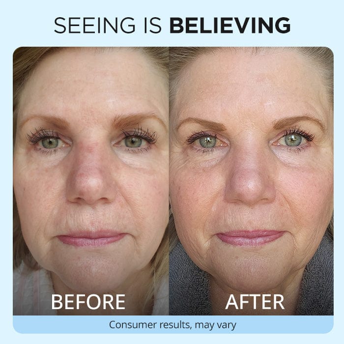 Anti Wrinkle Moisturizer - Free Gift - Image 3