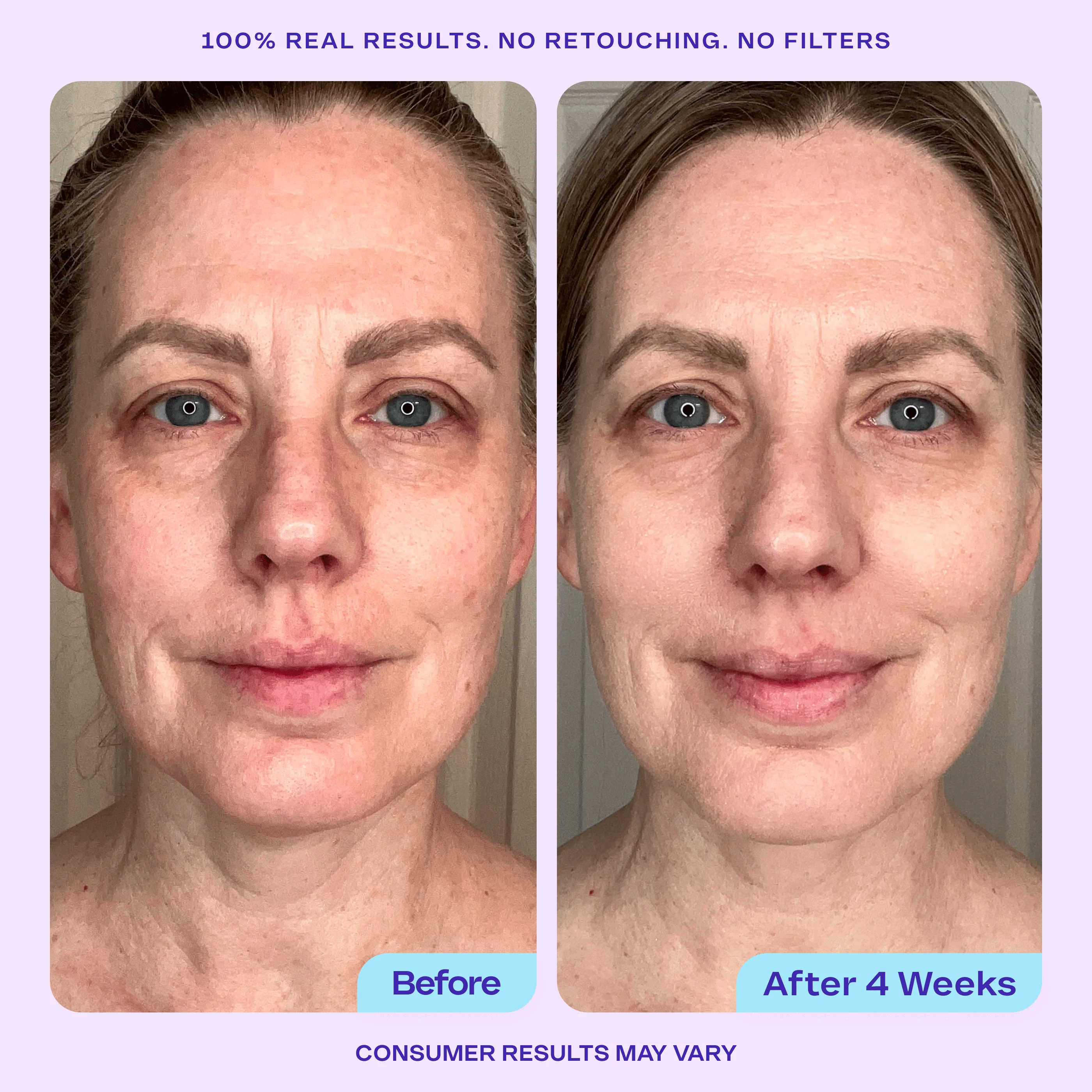 Instant Facial Exfoliation Set - Image 8