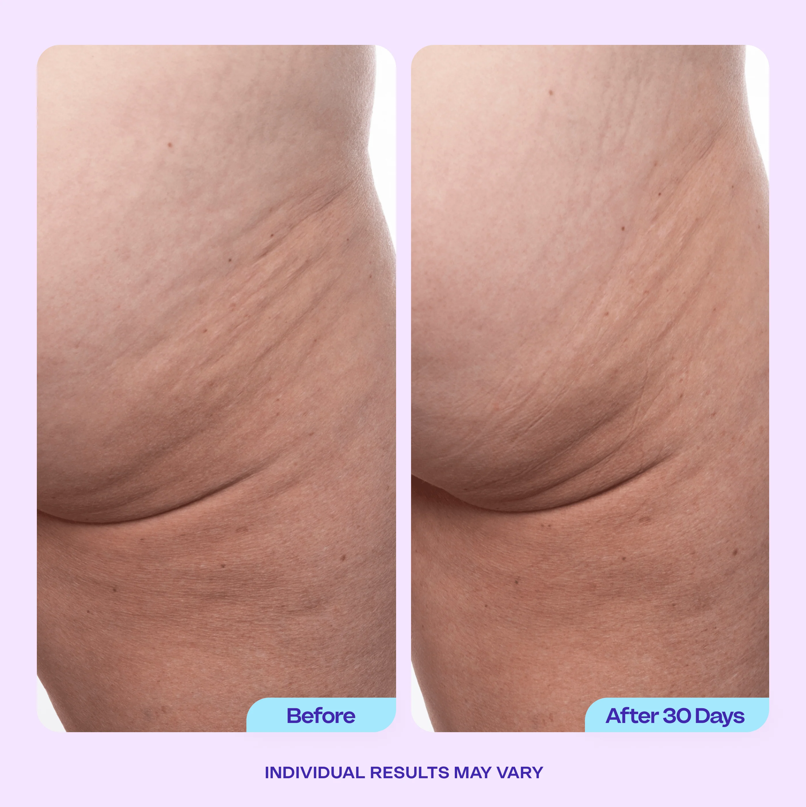 Firming Butt & Thigh Cream - Image 6