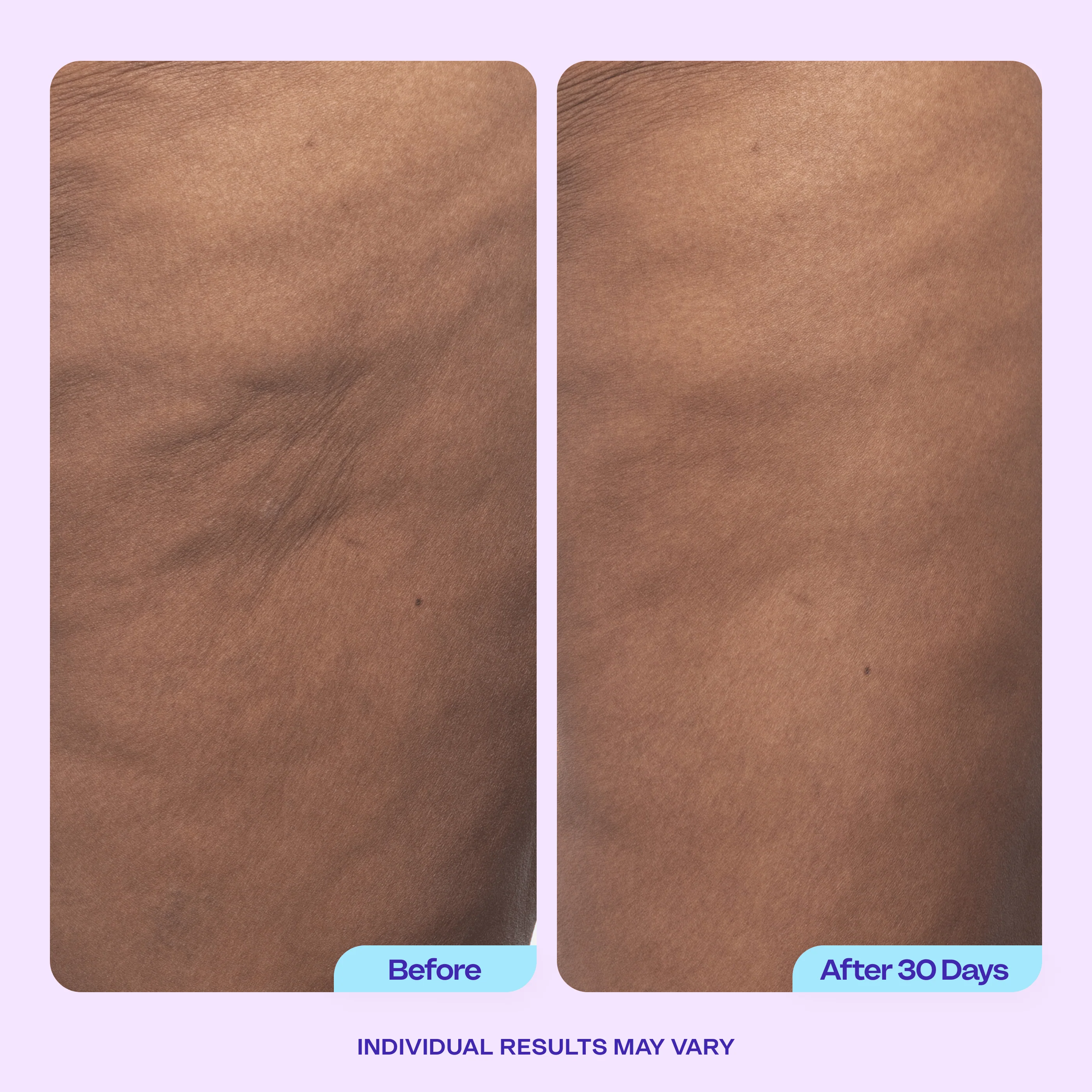 Body Confidence Set - Image 9