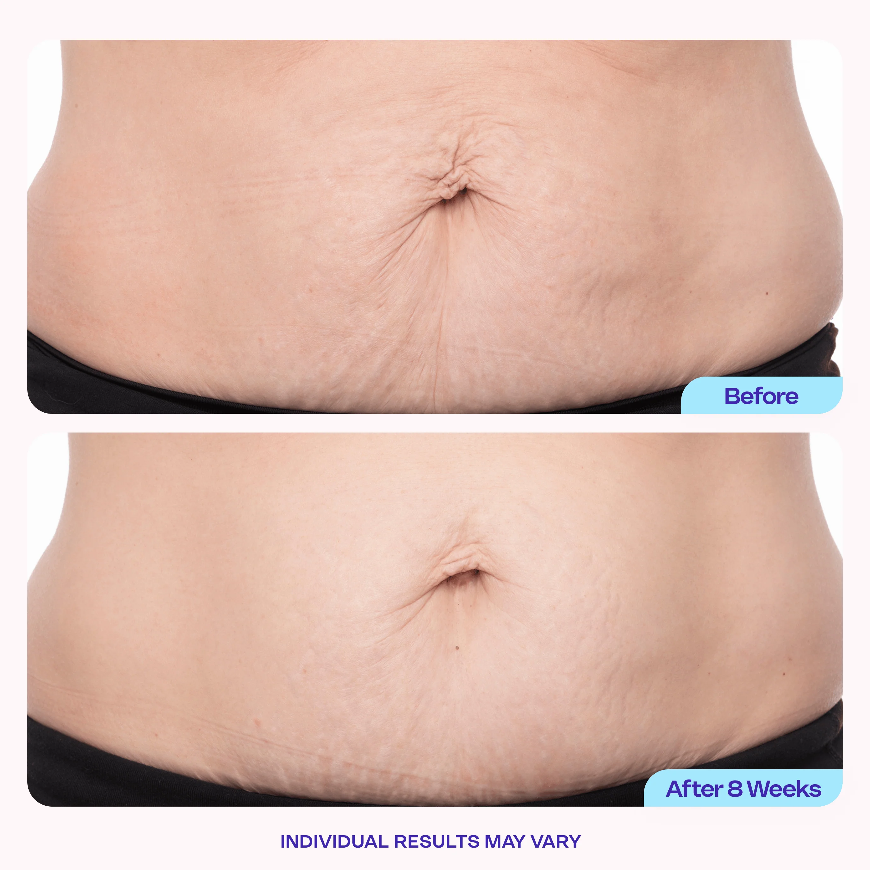 Exclusive Offer: Body Firming Trio - Image 5