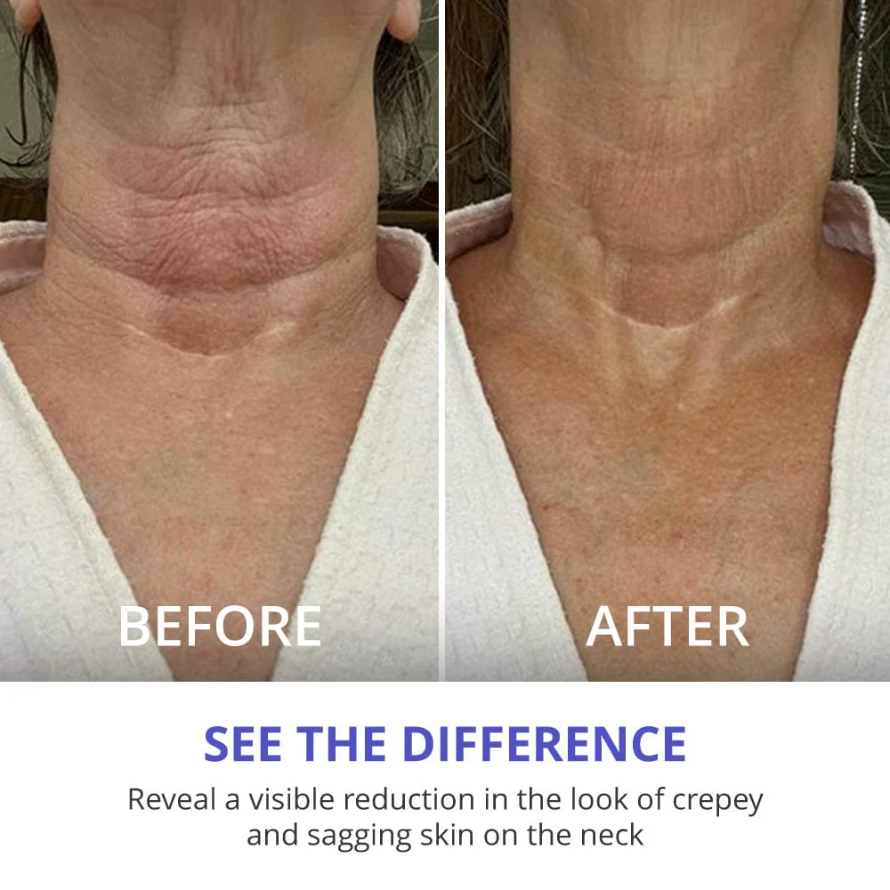 Exclusive Offer: Tighten & Lift Neck Cream 2 Jar - Image 4