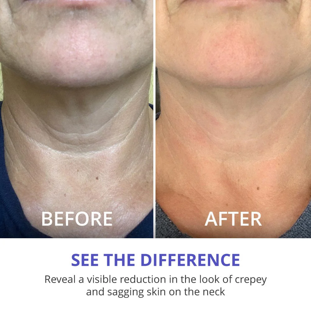 Exclusive Offer: Tighten & Lift Neck Cream 2 Jar - Image 8