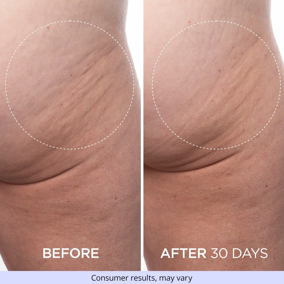 Firming Butt & Thigh Cream - Image 8