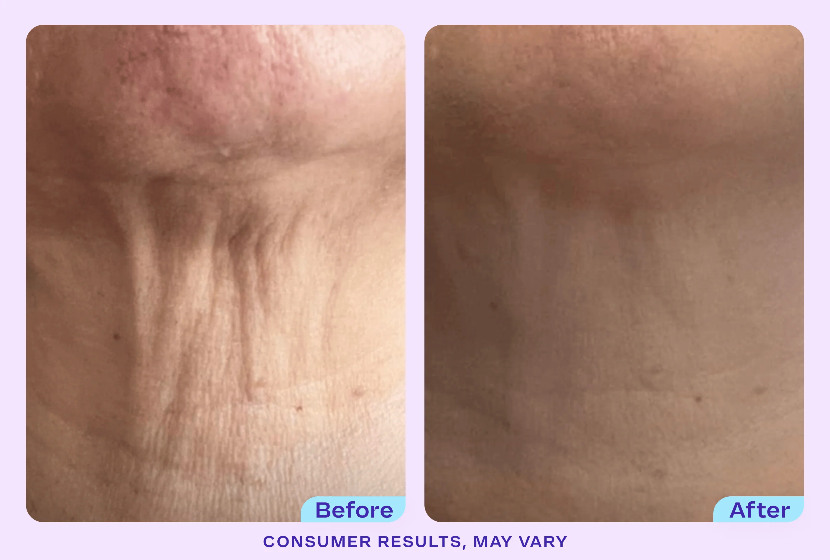 Tighten & Lift Neck Cream - NC41 - Image 3
