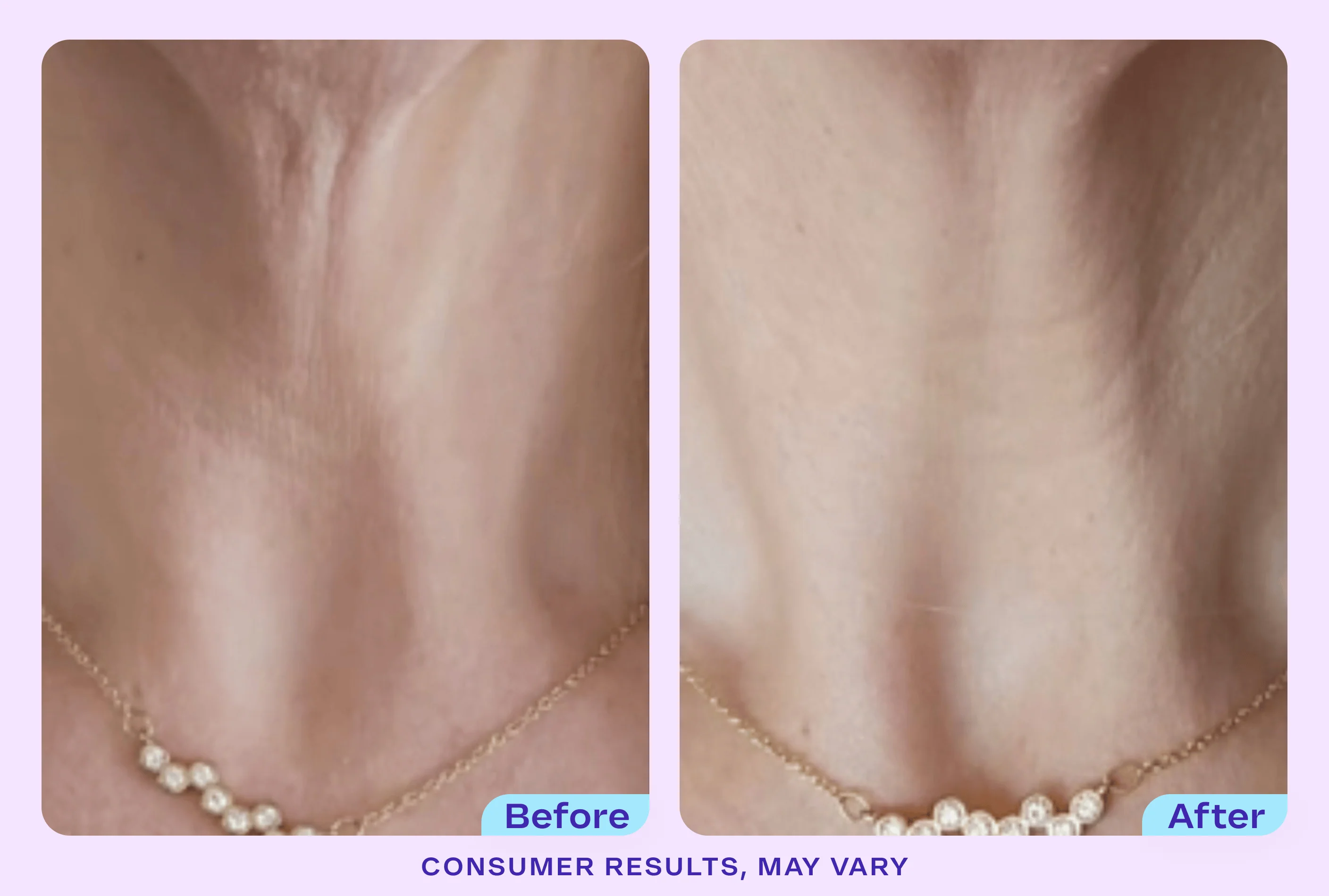 Tighten & Lift Neck Cream - NC41 - Image 5