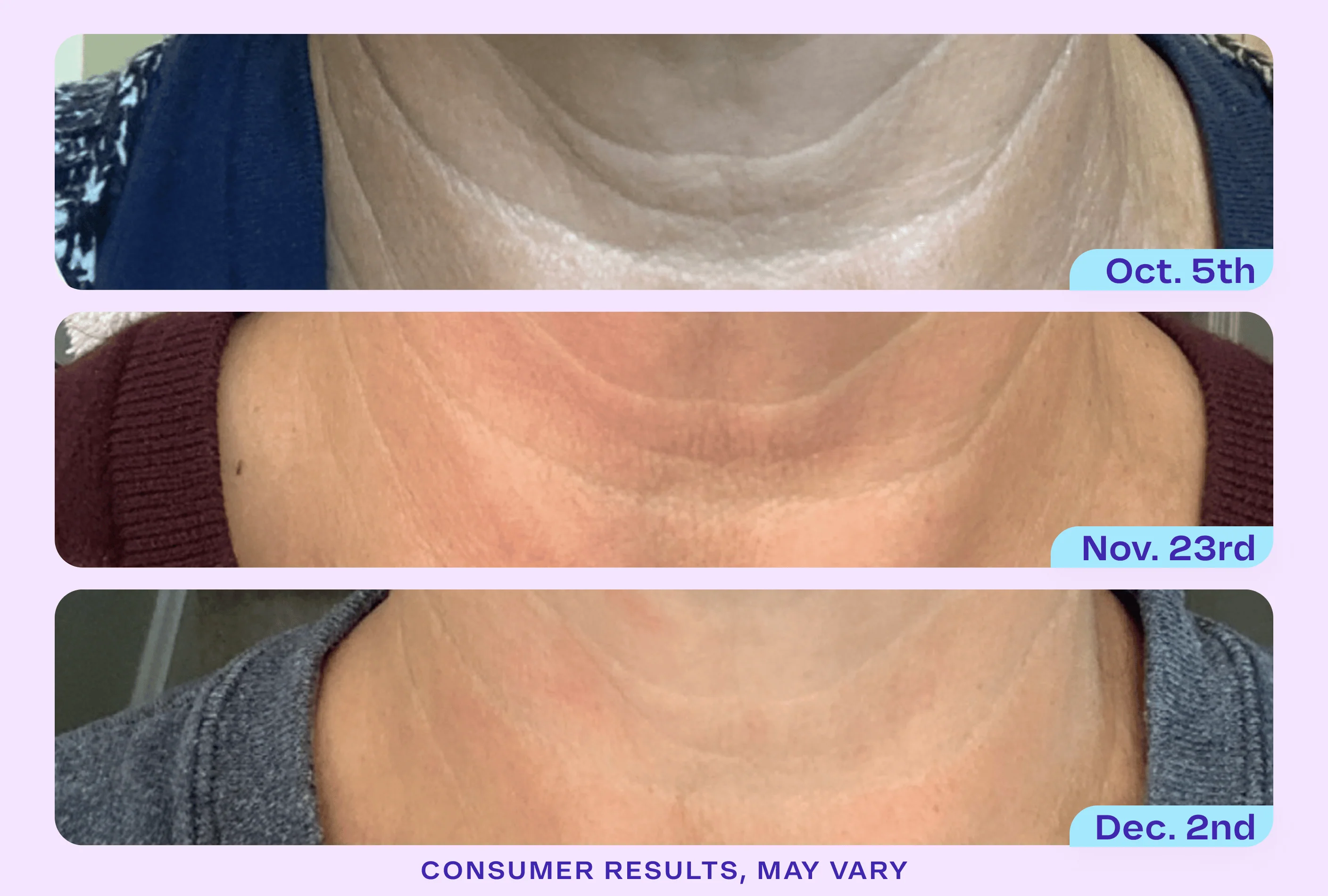 Tighten & Lift Neck Cream - NC41 - Image 7