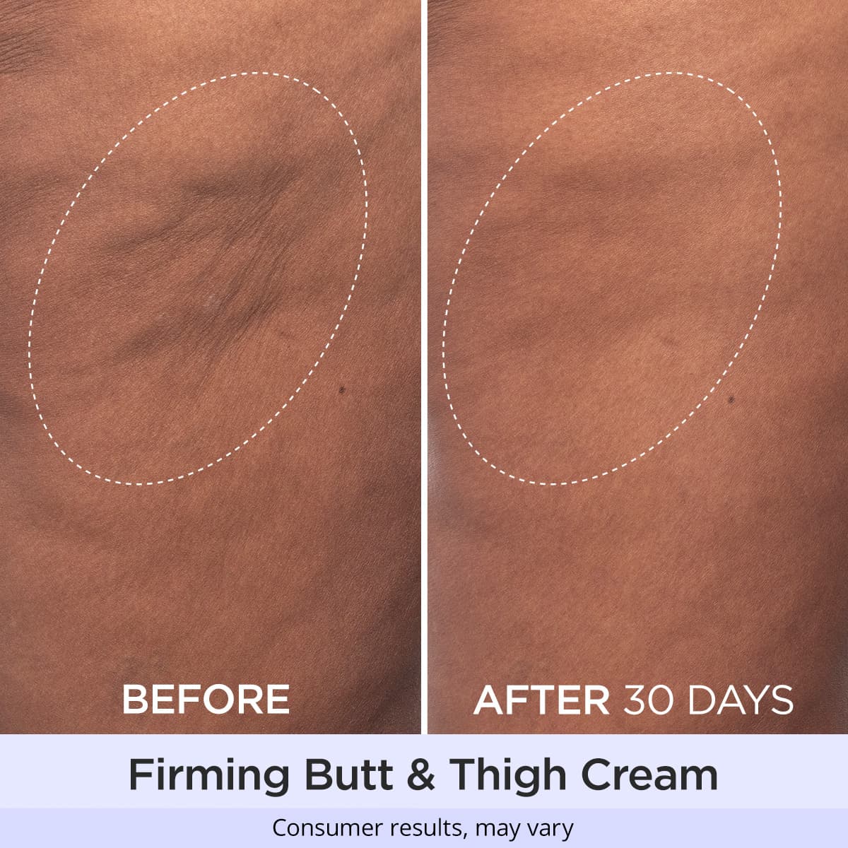 LIVE Butt & Thigh Firming Duo - Image 2