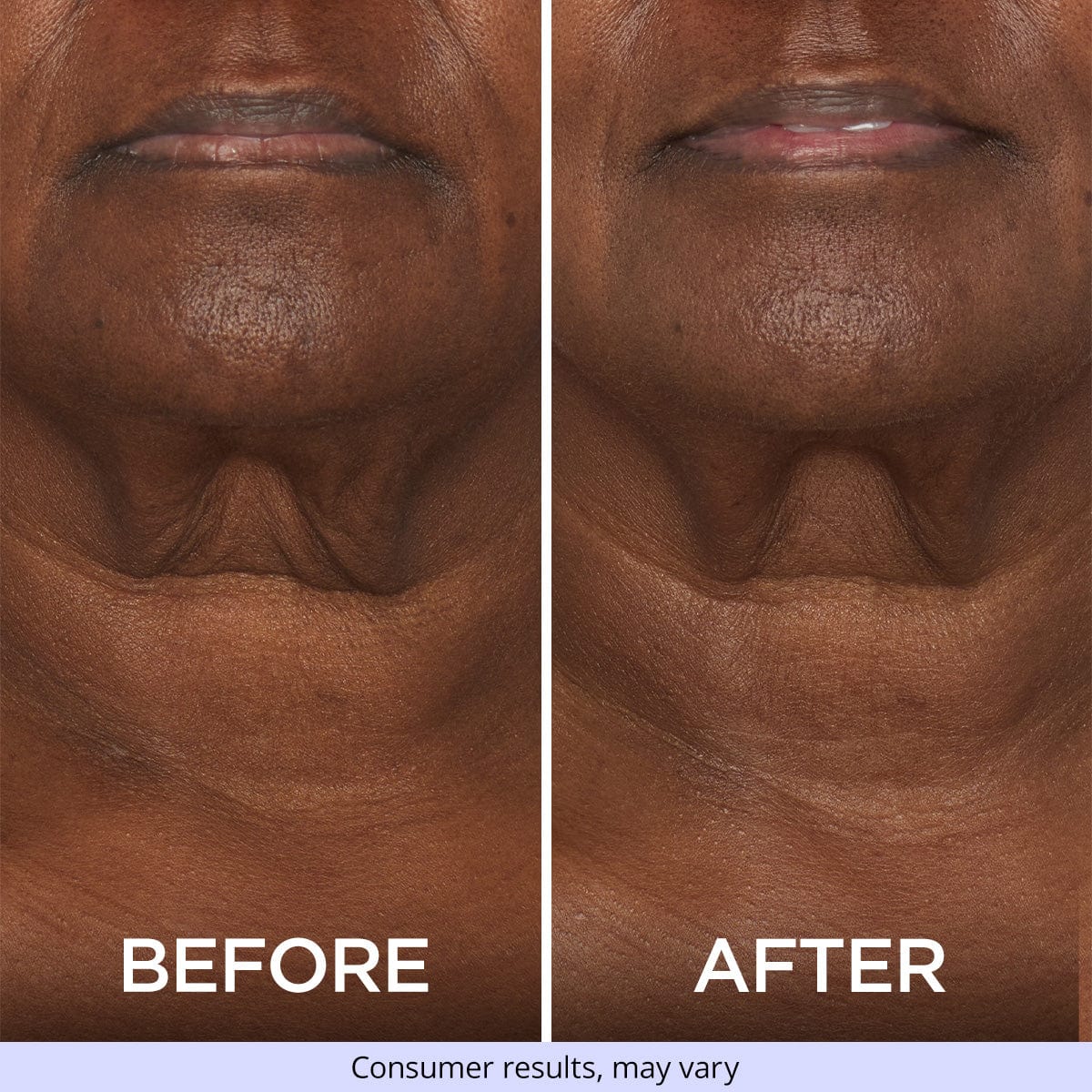 Sculpting Arm Cream + Tighten & Lift Neck Cream - Image 3