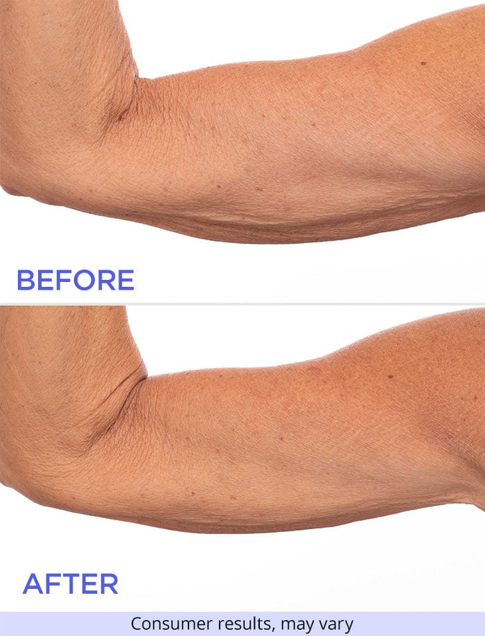 Sculpting Arm Cream + Tighten & Lift Neck Cream - Image 4