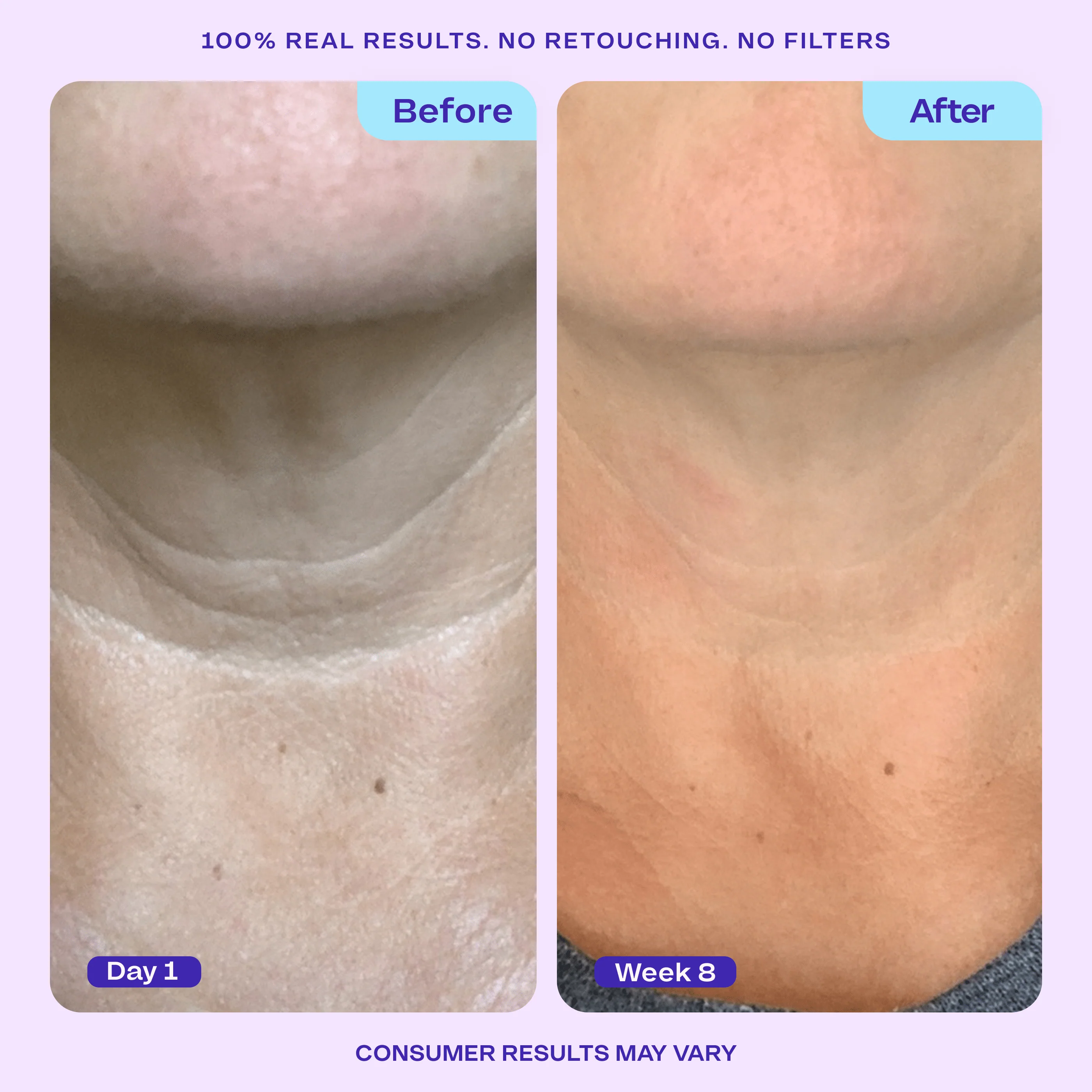 Arm Cream + Neck Cream - Image 3