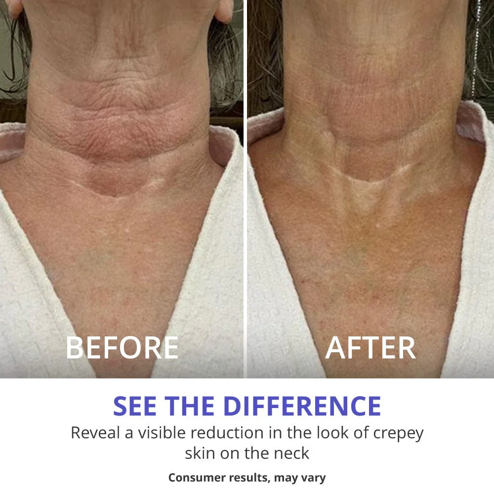 Tighten & Lift Neck Cream - Image 3