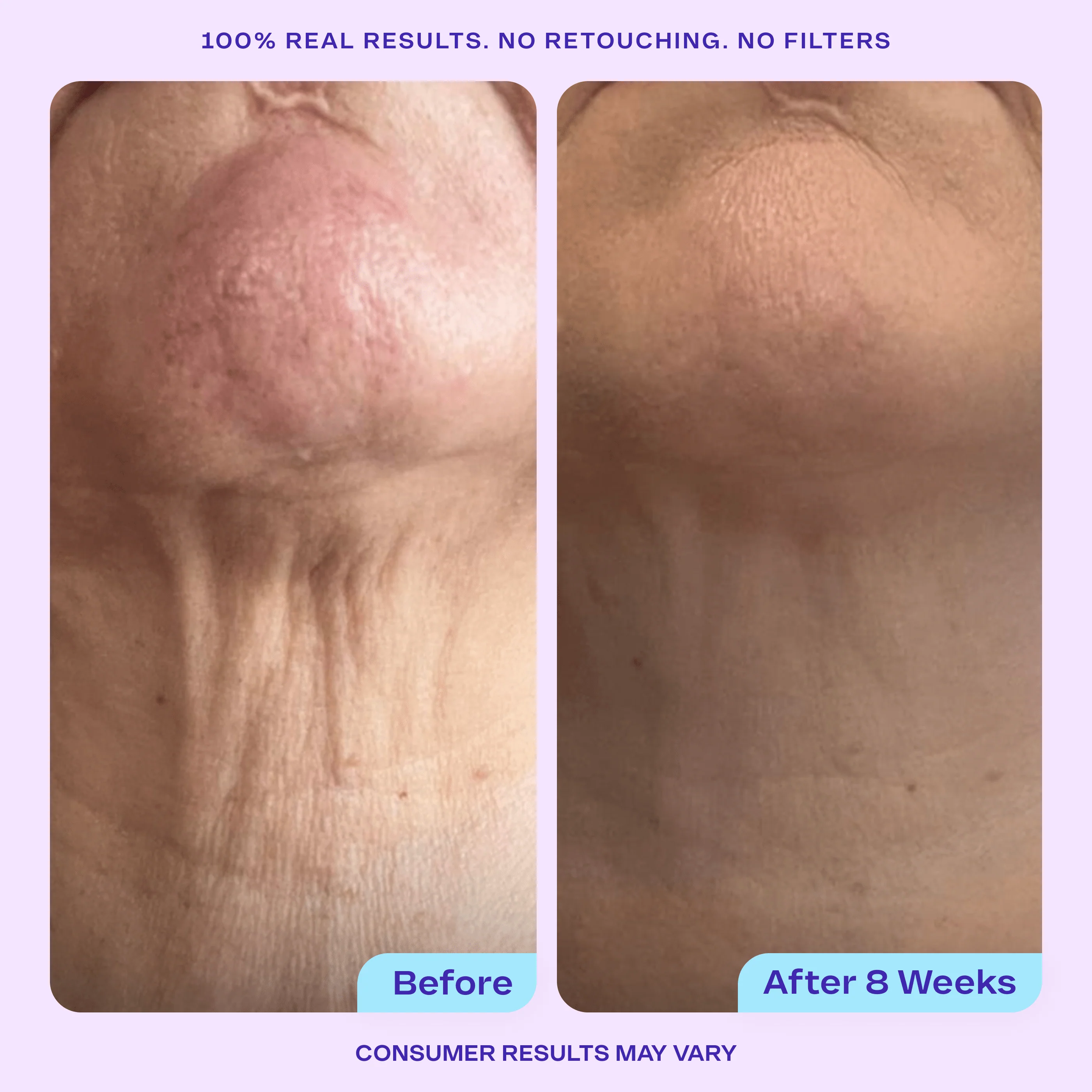 Total Body Firming Set - Image 6