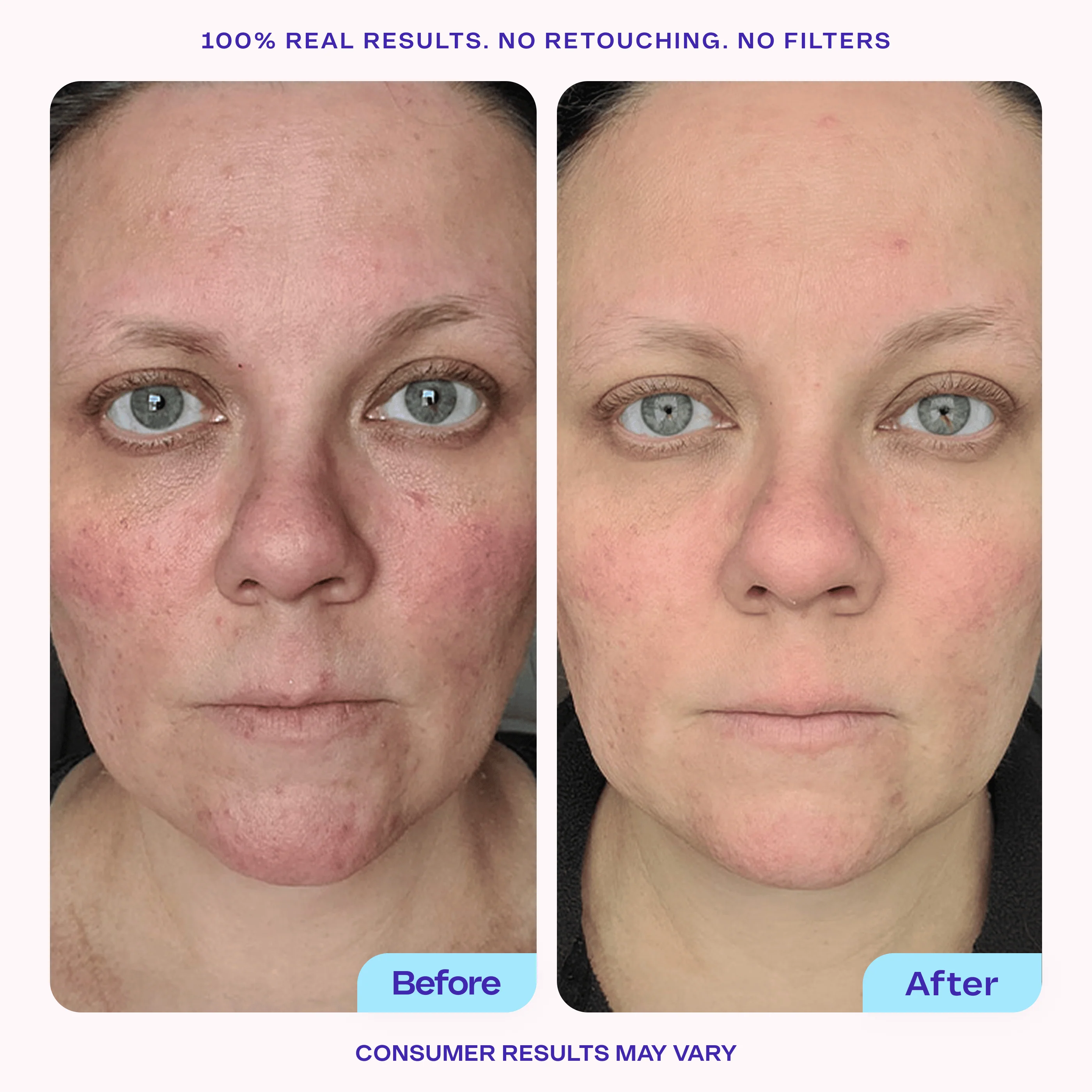Brighten & Even Serum - Image 3