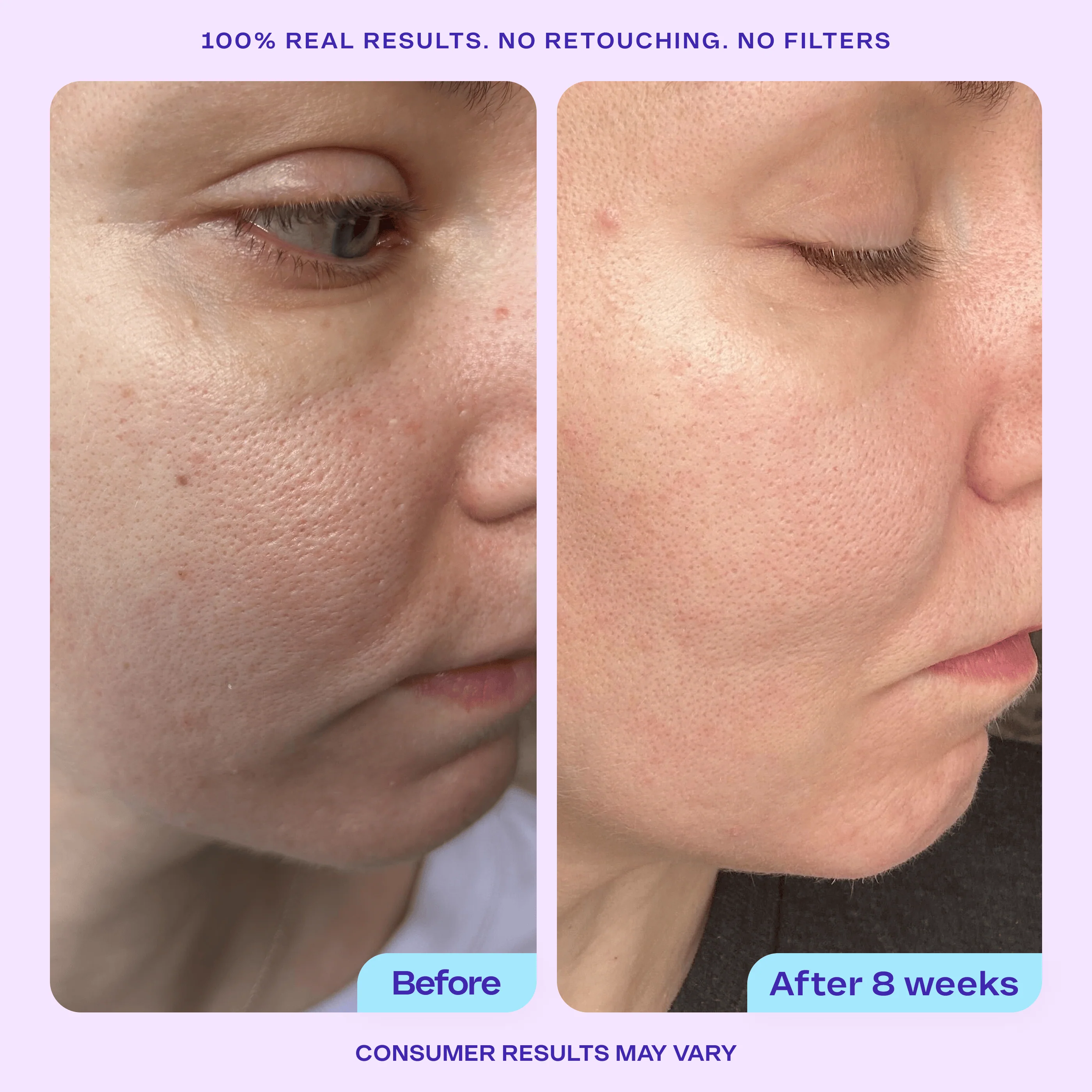 Refine It! BHA Liquid Exfoliant - Image 3