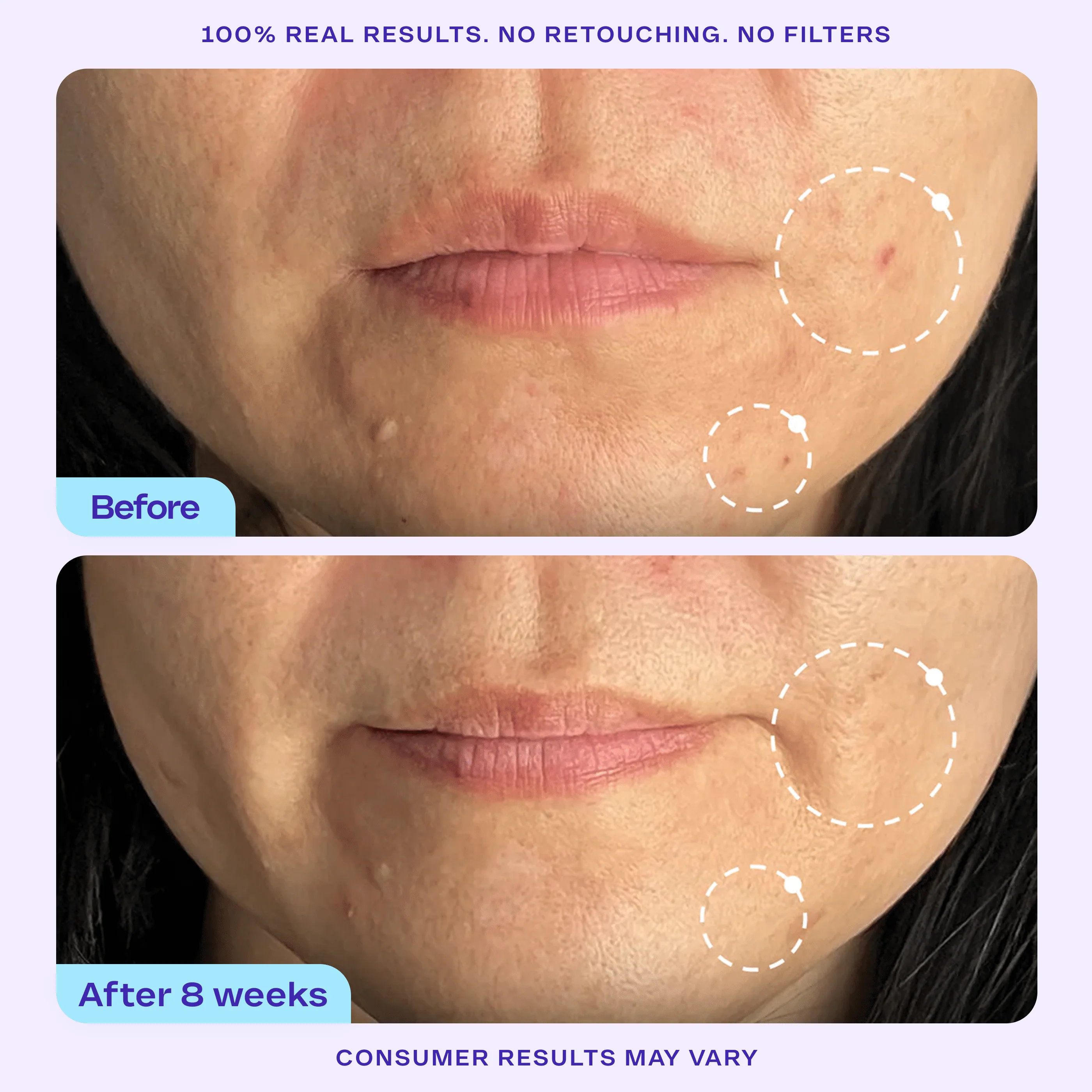 Instant Facial Exfoliation Set - Image 5